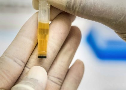 Durata di rilevamento delle droghe nelle urine: guida completa